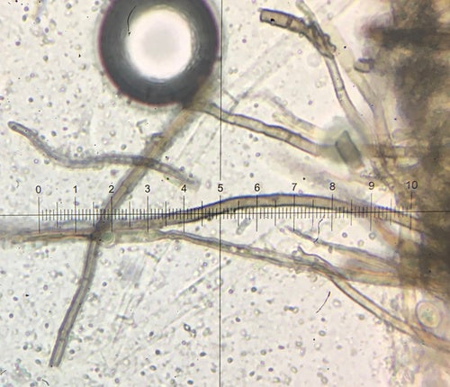 Kugeliger Borstenkugelpilz — Bild 3 von 21