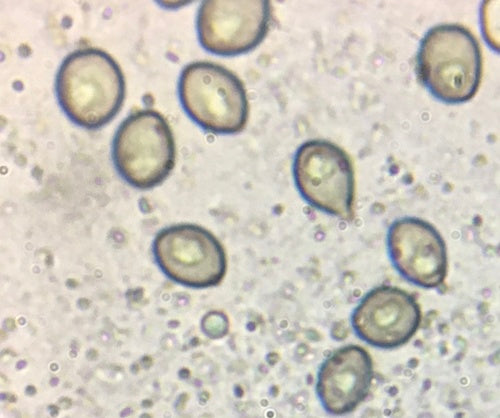 Kugeliger Borstenkugelpilz — Bild 2
