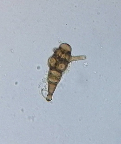 Ulocladium — Bild 1