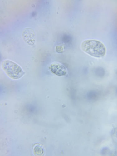 Wallemia-Schimmelpilz — Bild 1